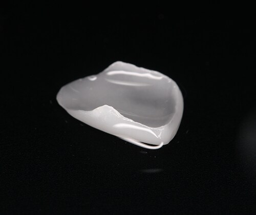 step04 歯の型取りを行い、咬み合わせや形を確認