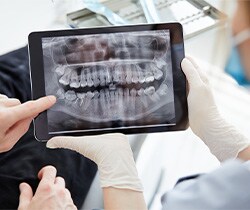 step02 お口の状態の検査