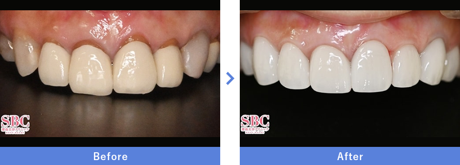 症例写真：大阪・22歳女性