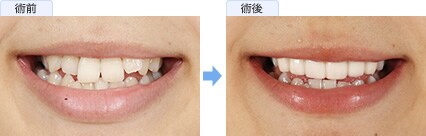 田中 その子さんの症例写真1