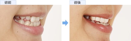 田中 その子さんの症例写真2