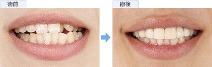 下道 梨良さんの症例写真1
