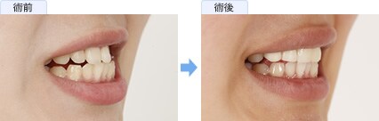 下道 梨良さんの症例写真2