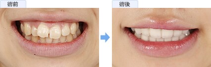 渡辺 奏さんの症例写真1