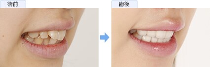 渡辺 奏さんの症例写真2