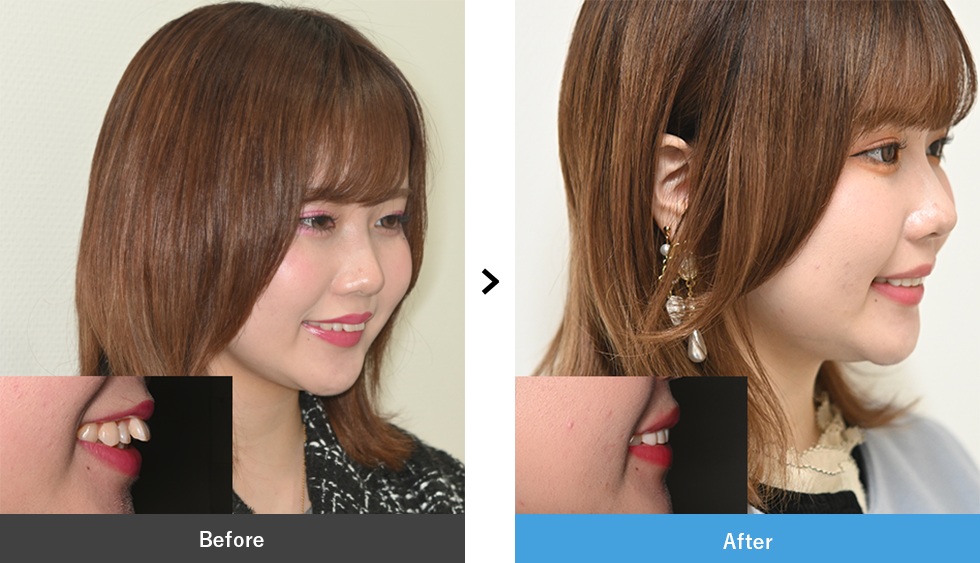 セラミック 症例写真