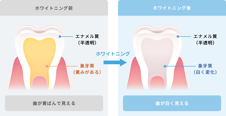 ホワイトニングのメカニズム