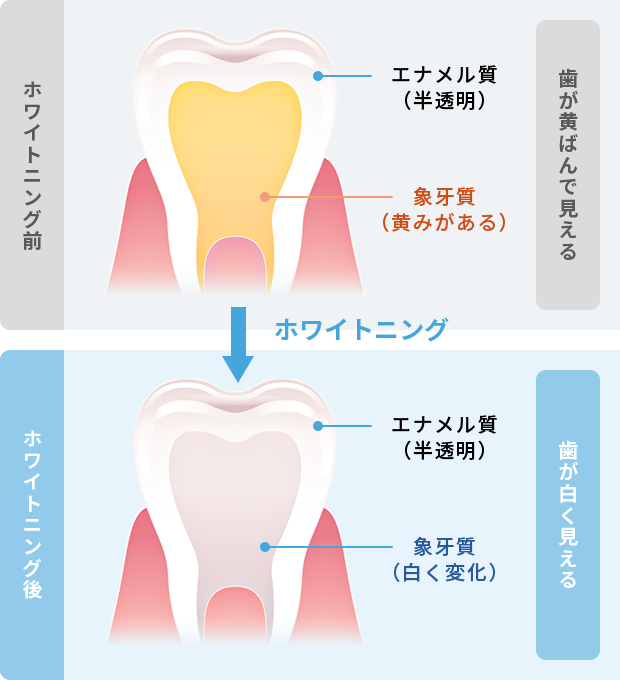 ホワイトニングのメカニズム