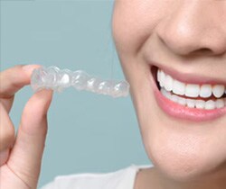 マウスピースの制作と治療開始