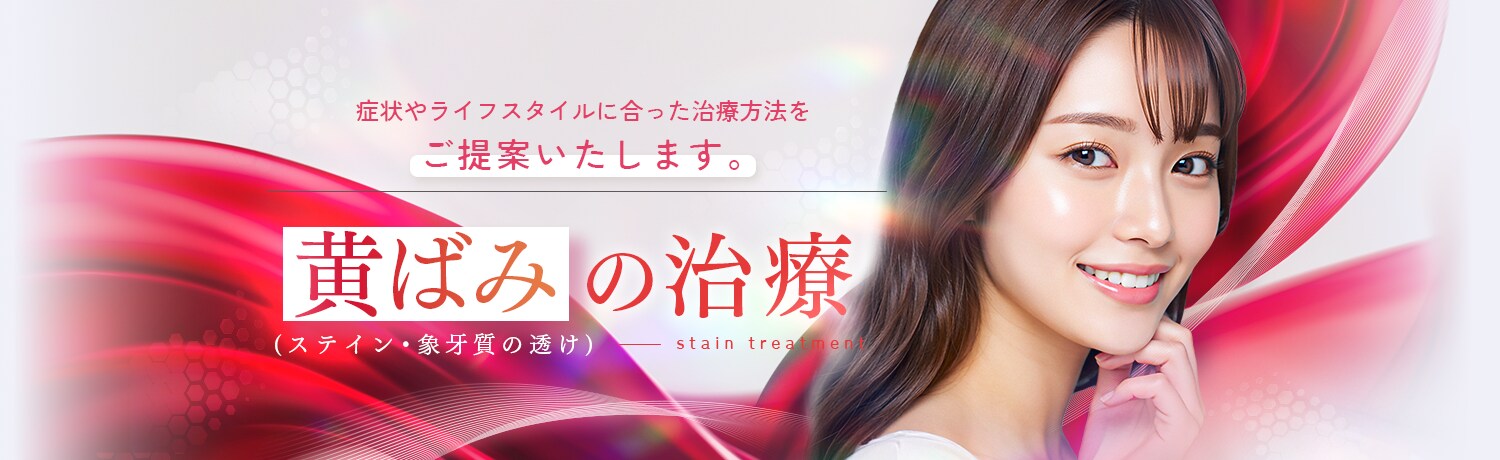 歯の黄ばみ治療