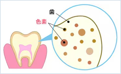 歯の色素
