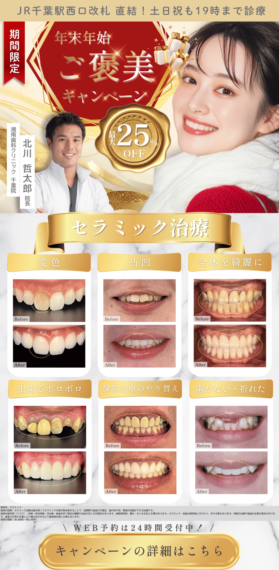 期間限定キャンペーン