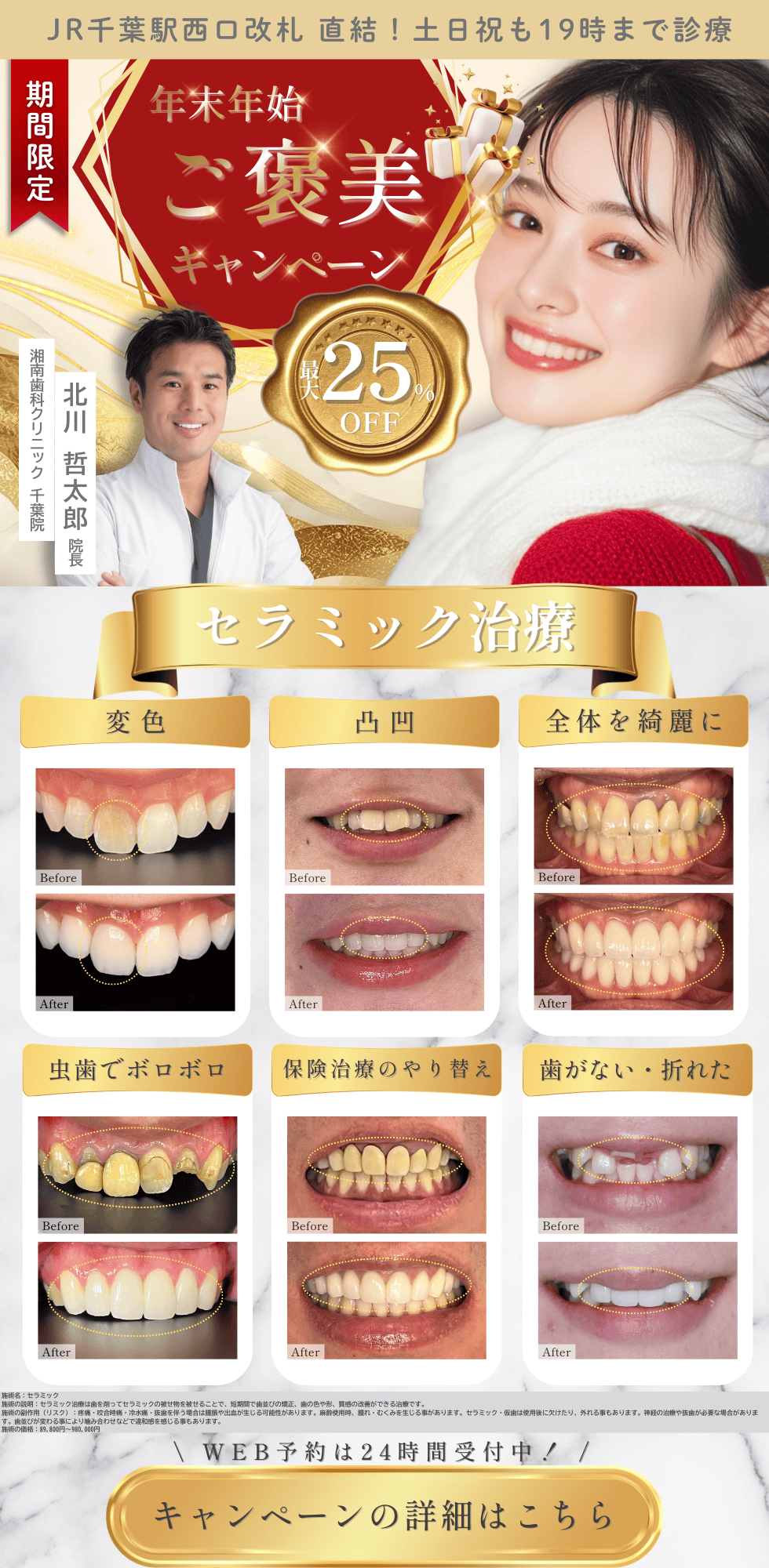 期間限定キャンペーン