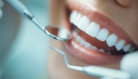 ②クリーニング