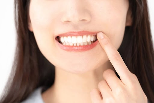 千葉ですきっ歯の治療をするなら湘南美容歯科千葉院！