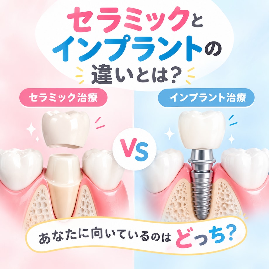 セラミック治療とインプラント治療の違いを徹底比較！悩みを解決する選び方