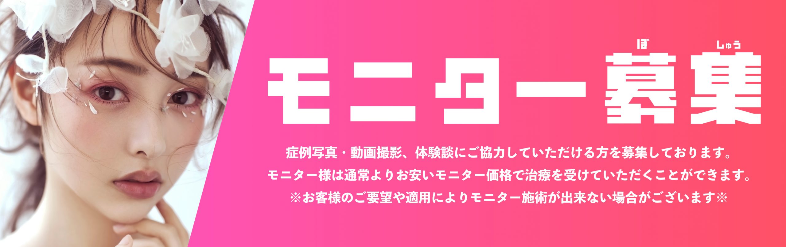 湘南美容クリニック福岡院歯科のモニター募集