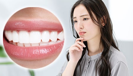 歯が白くなりすぎて不自然になることはありませんか?<br />