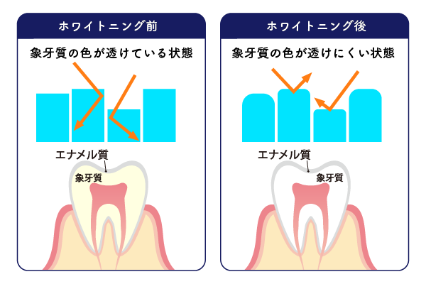 マスキング効果で、より白い歯に