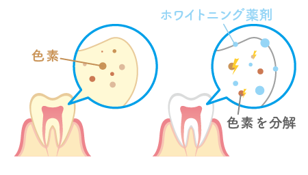 黄ばみがなくなる仕組み