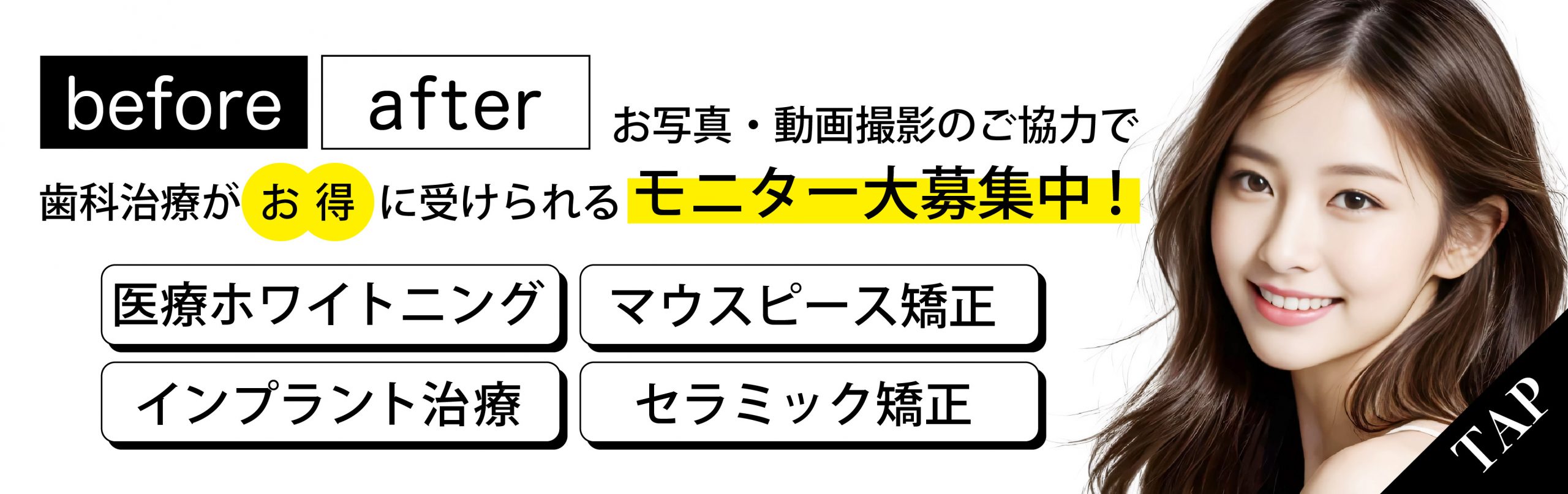 湘南美容クリニック福岡院歯科のモニター募集
