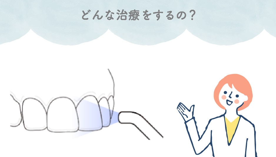 特殊な樹脂を歯の表面に浸透させて、歯の白濁を目立ちにくくする治療