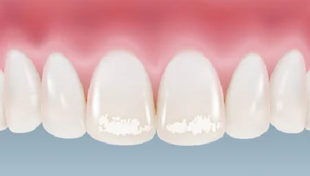 白く見える仕組み