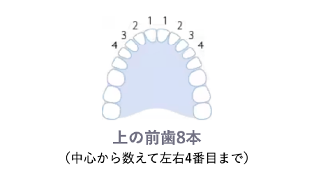 ダイヤモンドベニア