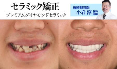 「症例数」がやばい