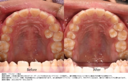 実際にどう動いた？