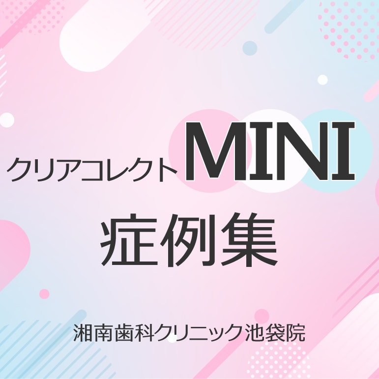 【症例集】クリアコレクトMINI【湘南美容歯科池袋院】