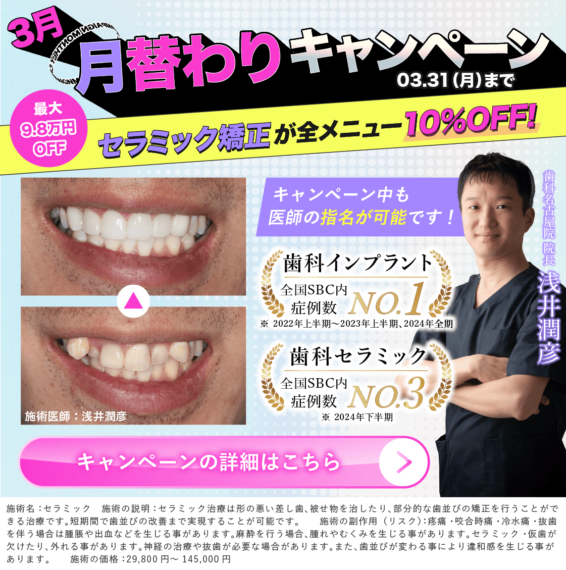 3月限定キャンペーンは【セラミックが全メニュー10％OFF】！！