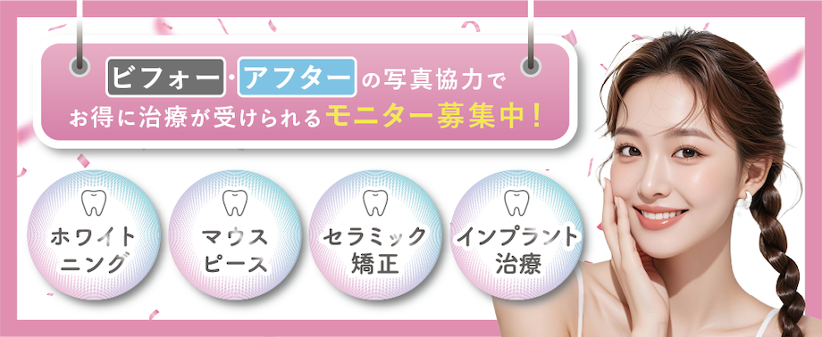 湘南歯科クリニック名古屋院のモニター募集
