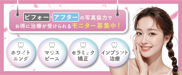 湘南歯科クリニック名古屋院のモニター募集