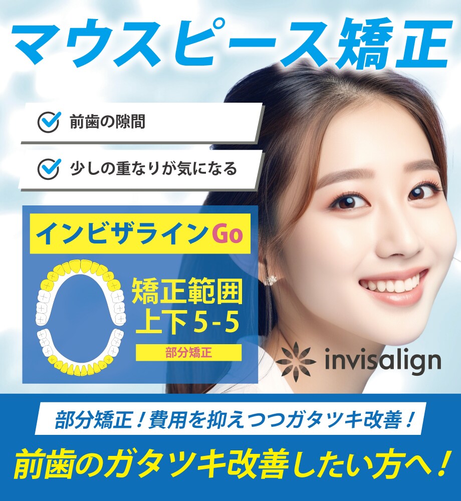 費用を抑えつつ《部分的なガタつき》を改善したい方向け！