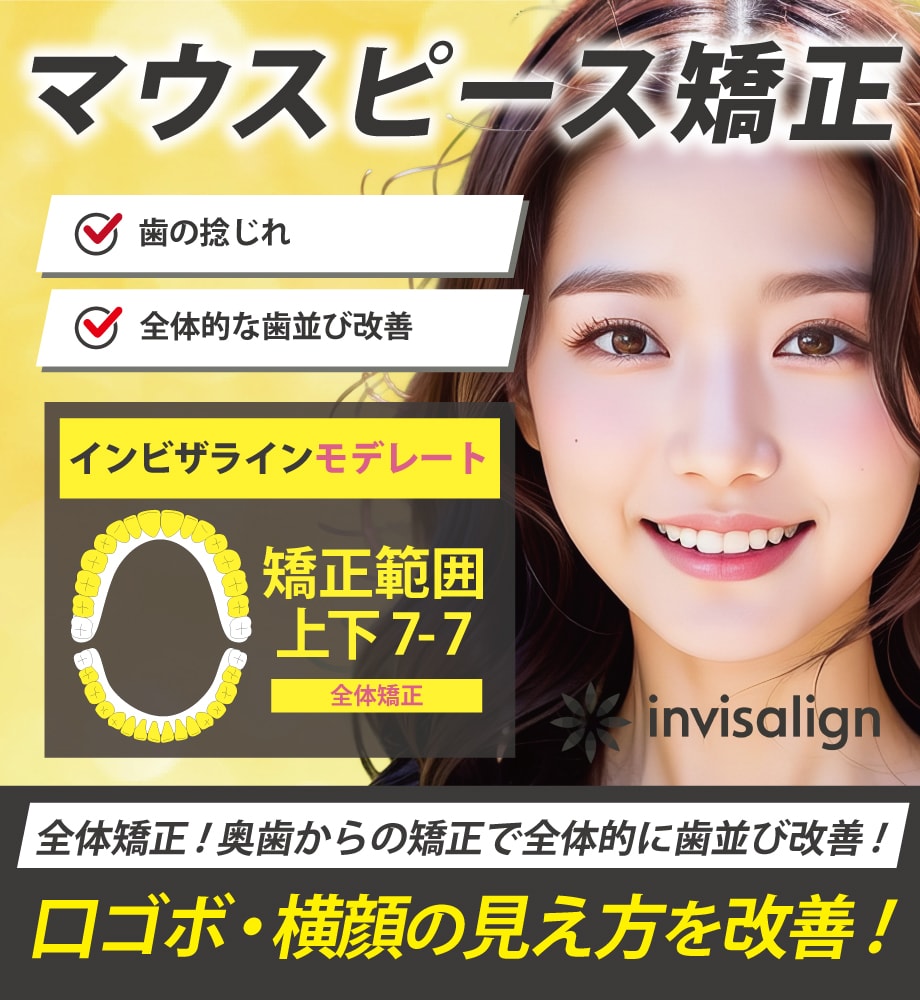 《奥歯から全体的に》歯を動かしたい方向け！