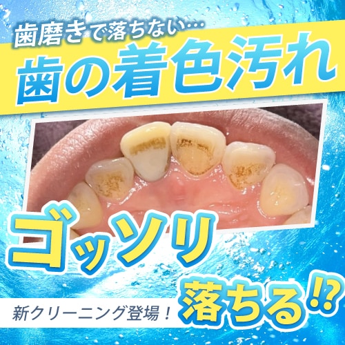 【歯の着色汚れゴッソリ除去】歯のクリ―ニングで細かい汚れを確実に撃退！(埼玉/大宮)