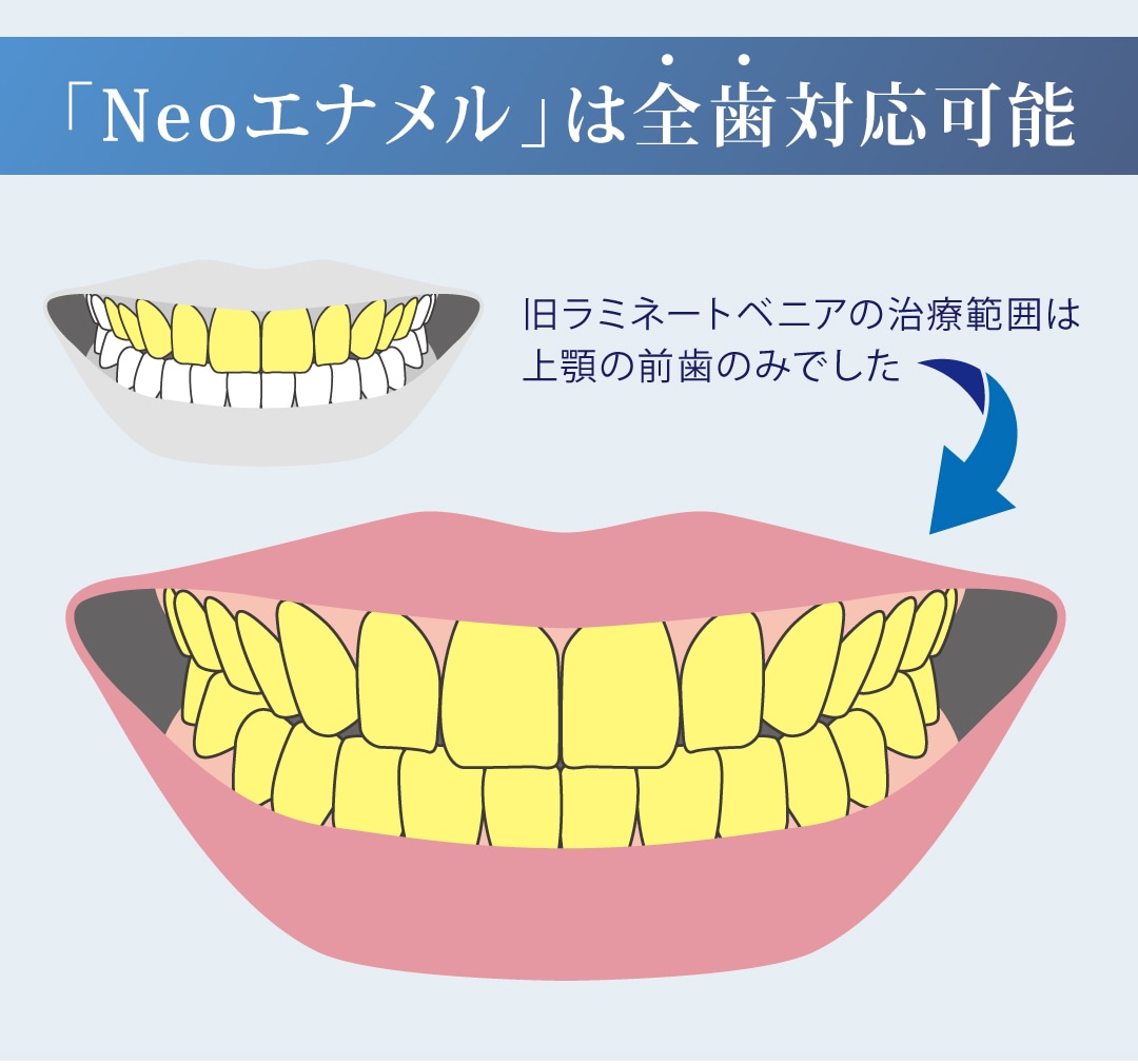 適用部位は全部の歯