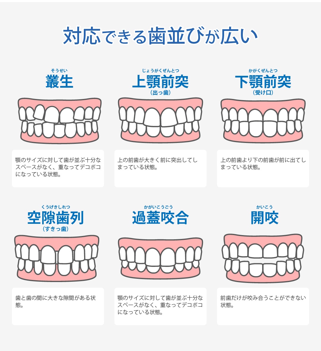 対応できる歯並びが広い