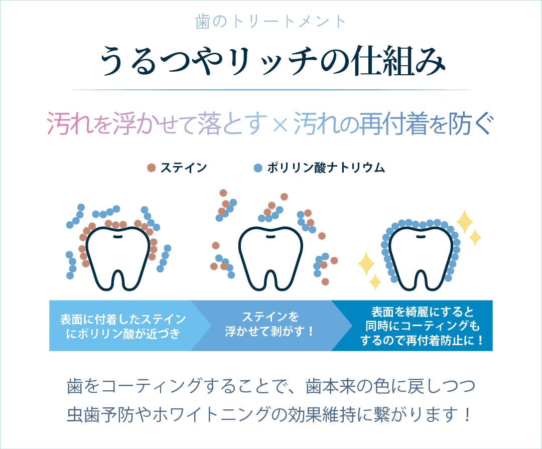 クリニックでできるケア:歯のトリートメント