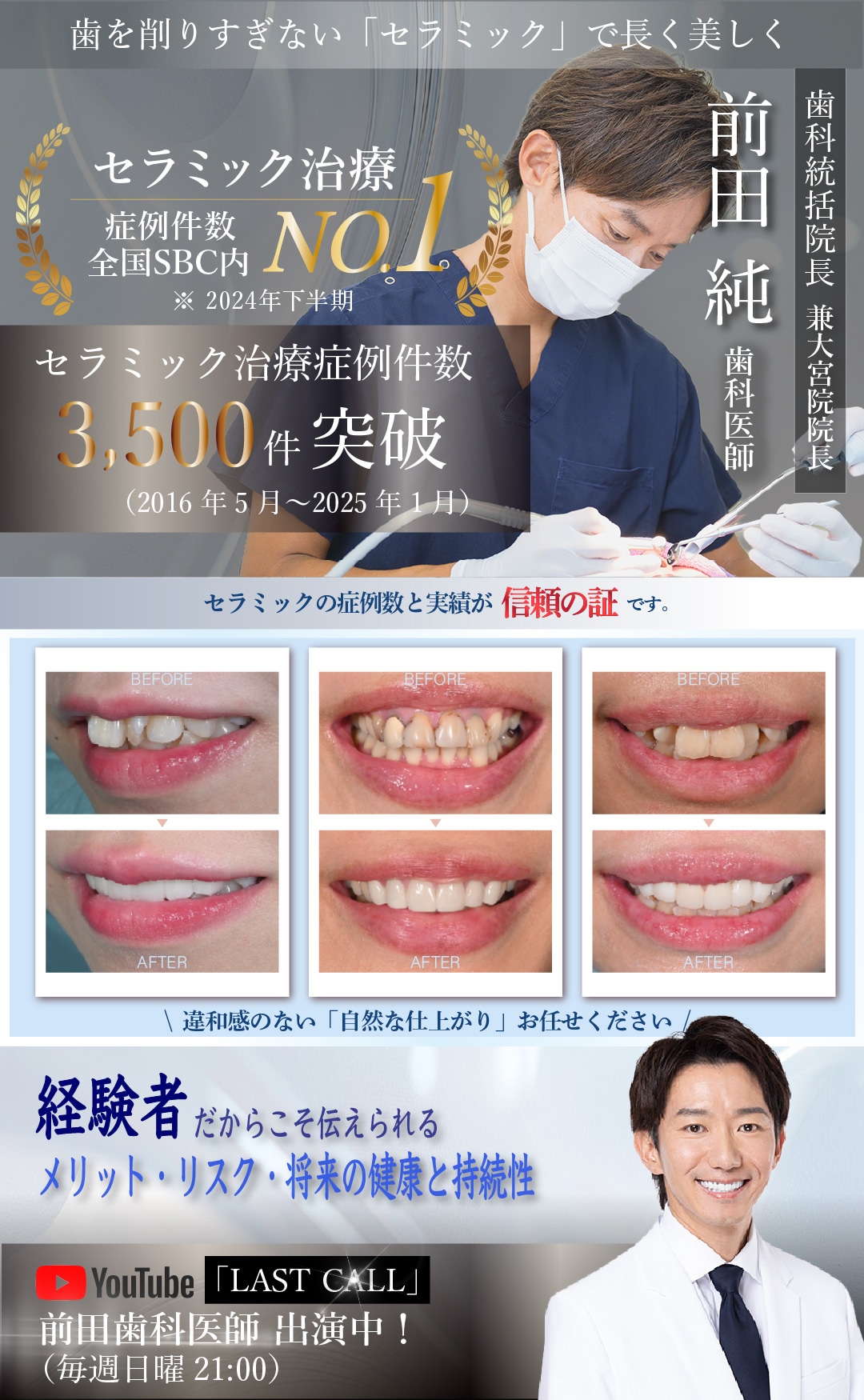 「マウスピース矯正」選ぶなら実績のある湘南歯科クリニック大宮院！インビザラインパープルダイヤモンドプロバイダー受賞！症例件数多数！