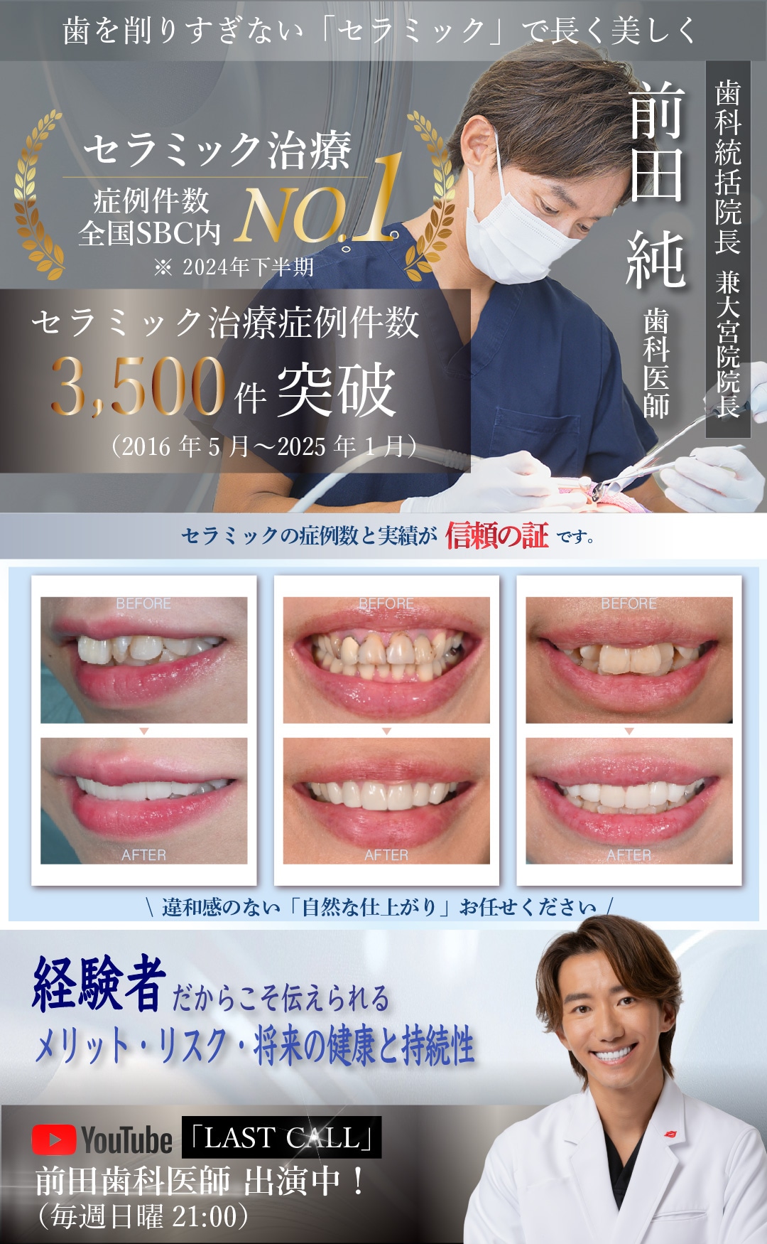 「マウスピース矯正」選ぶなら実績のある湘南歯科クリニック大宮院！インビザラインパープルダイヤモンドプロバイダー受賞！症例件数多数！