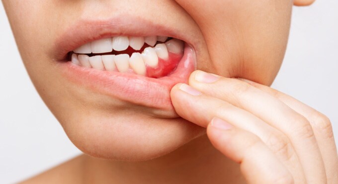 日本歯周病学会専門医の資格を持ち、矯正しながら歯周病治療が可能