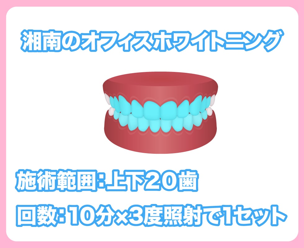 1. オフィスホワイトニング