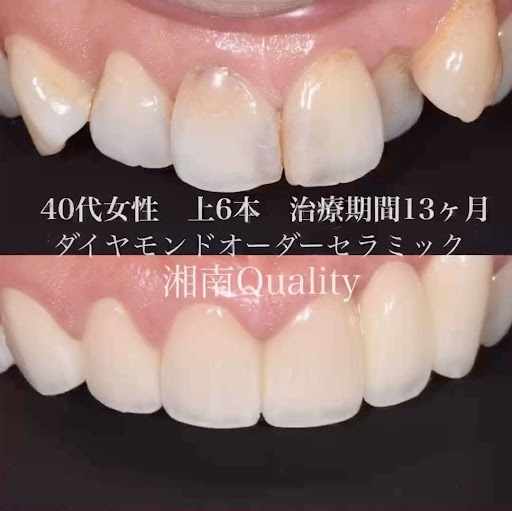 ダイヤモンドオーダーセラミック