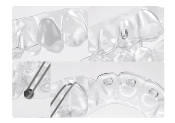 一人ひとりのお口に合わせた設計