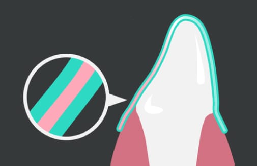 独自の３層構造を持ったアライナー