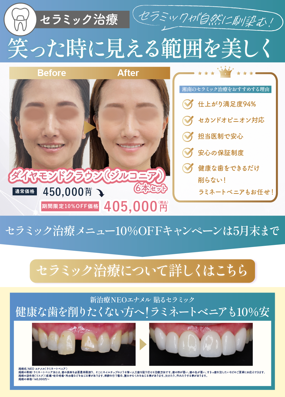 湘南美容歯科-大阪心斎橋院（大阪府）｜セラミック矯正・治療