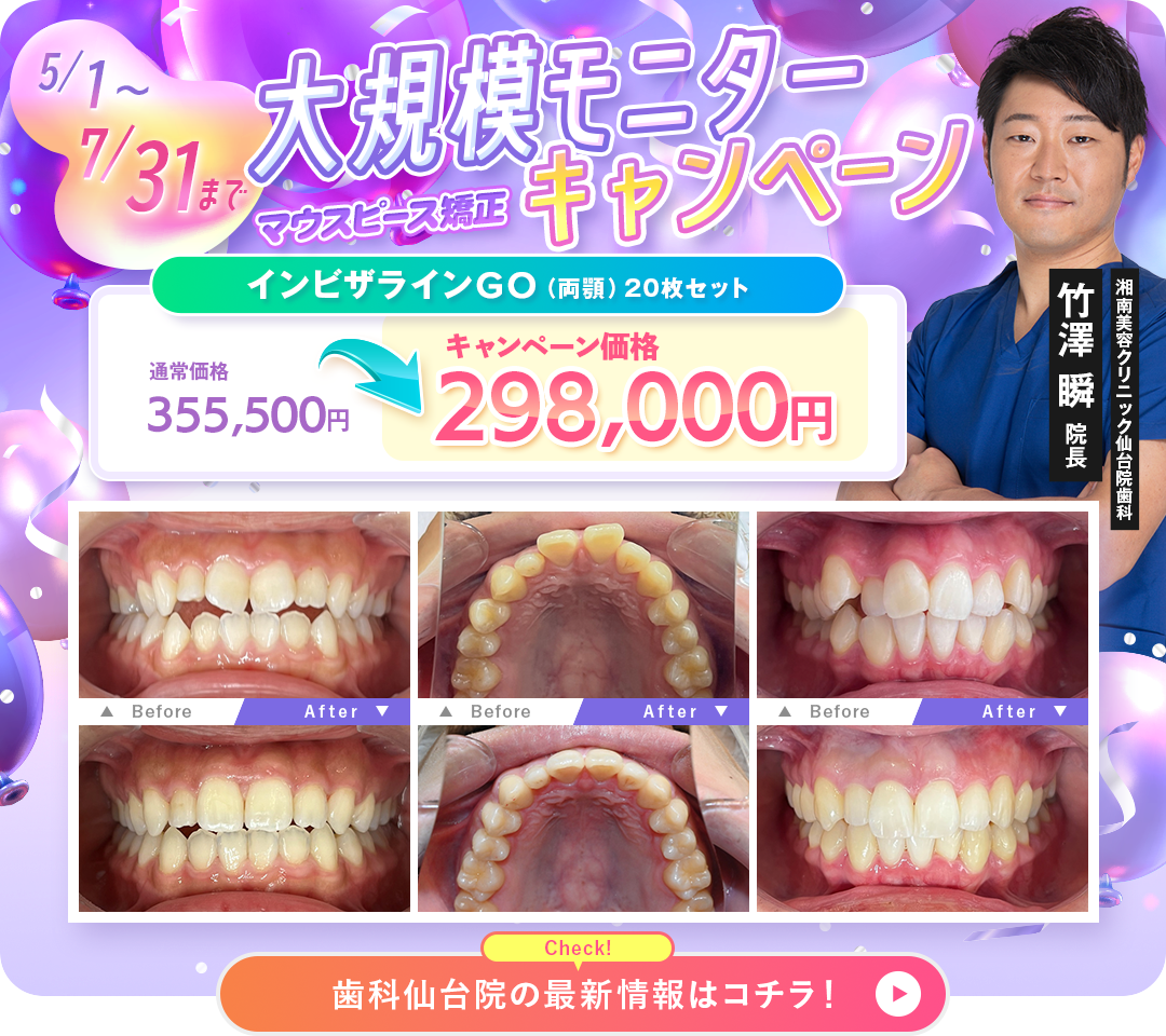 大規模モニターキャンペーン