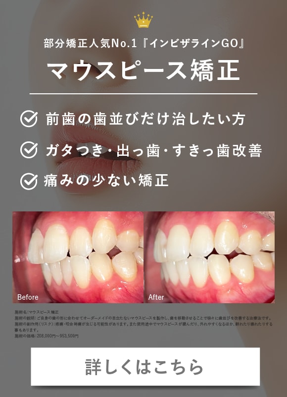 【気になる前歯だけサクッと矯正！】安心のインビザラインで一生困らない歯並びに！